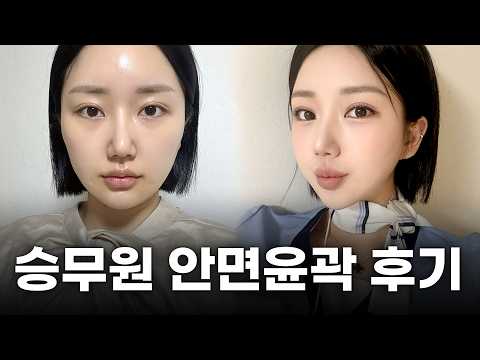 관리 끝판왕 승무원의 안면윤곽 후기ㅣ디에이성형외과ㅣ안면윤곽
