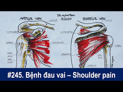 #245. Bệnh đau vai và tổn thương cơ quay khớp vai - Shoulder pain and rotator cuff injury