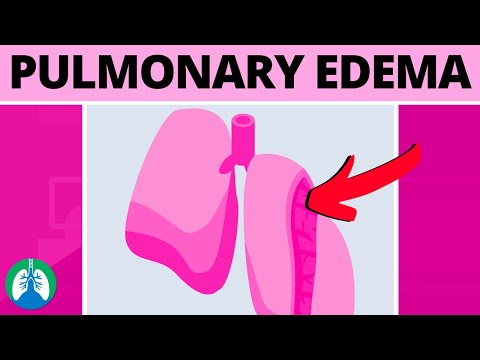 Pulmonary Edema (Medical Definition) | Quick Explainer Video