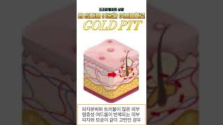 YouTube 영상