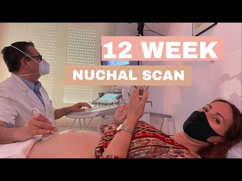 Nuchal Translucency Ultrasound 12 Weeks Pregnant