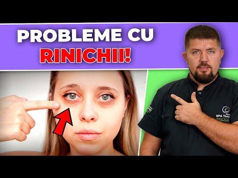 What does our skin tell us about our health? 99% of people don't pay attention to this!