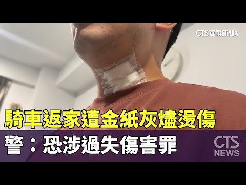 騎車返家遭金紙灰燼燙傷　警：恐涉過失傷害罪