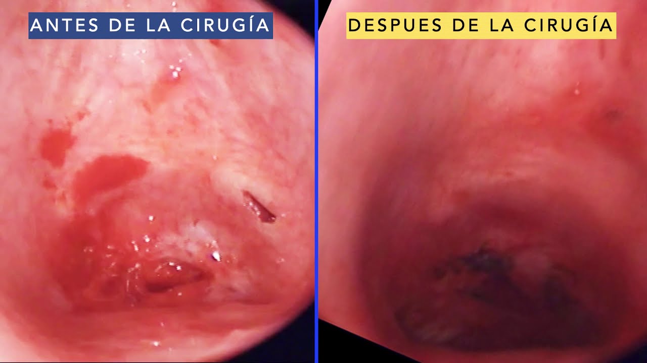 Joaquín Archibaldo Hope Guerrero-9