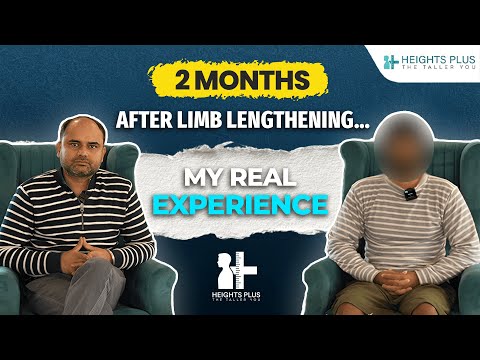 Patient Experience After 2 Months of Limb Lengthening Surgery at Heights Plus.