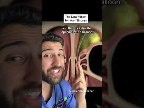 Unblocking Your Nose When All Else Fails #sinusitis