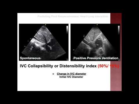 Point of Care Ultrasound (POCUS) for Regional Anaesthetists