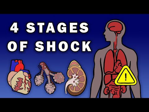 THE 4 STAGES OF SHOCK
