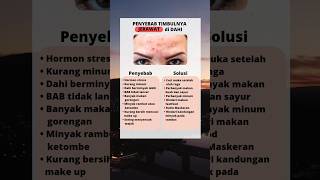 Download lagu Jangan di Skip!!! Faktor Penyebab Jerawat Timbul di Dahi,,,,, #tips #glowup #glowing #jerawat mp3 Download lagu Jangan di Skip!!! Faktor Penyebab Jerawat Timbul di Dahi,,,,, #tips #glowup #glowing #jerawat mp3