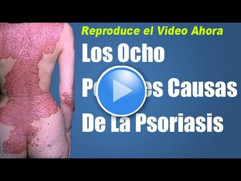 La diatesis y la eccema El tratamiento de la psoriasis en ramenskom