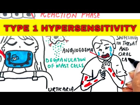 Type I Hypersensitivity – The Allergy That Could Kill in Minutes!