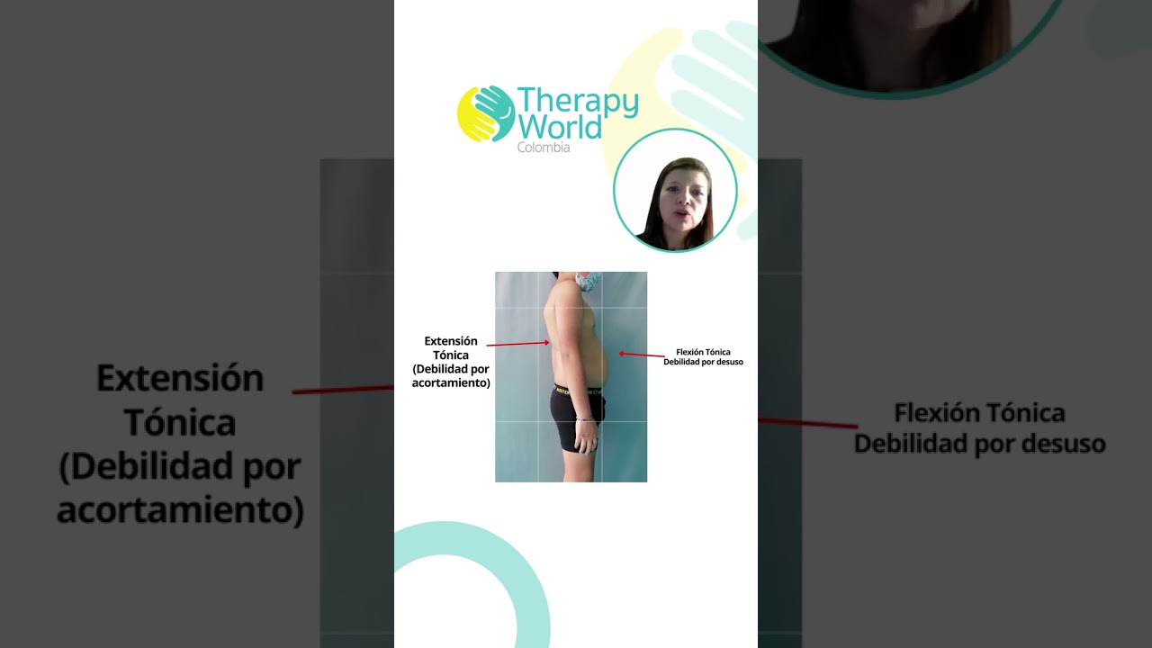 Control Postural Tónico