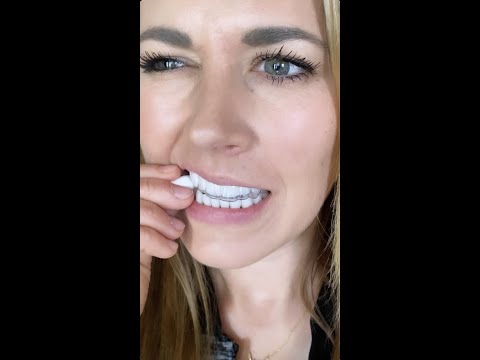 Retainer doesn't fit?  Here's what to do... 🦷 #shorts