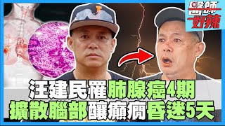 汪建民驚罹肺腺癌四期！「擴散到腦部」引發癲癇！失去意識昏迷5天！【醫師好辣】汪建民 必看精彩片段