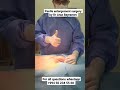 Penile Enlargement Surgery By Dr Araz Bayramov AUA Member EAU Active Member Andrologist Penis