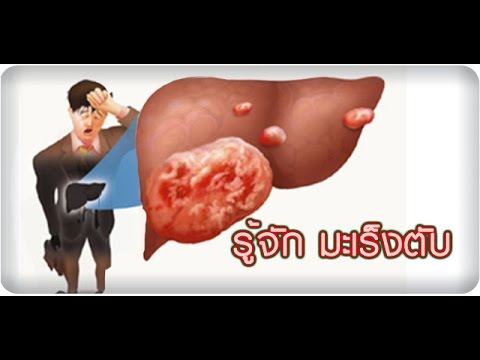 Ursofalk ในโรคสะเก็ดเงิน โรคสะเก็ดเงินผื่นบนขา