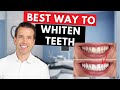 Why Your Teeth are Yellow | How to fix Stained teeth🦷