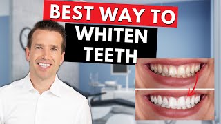 Why Your Teeth are Yellow | How to fix Stained teeth🦷