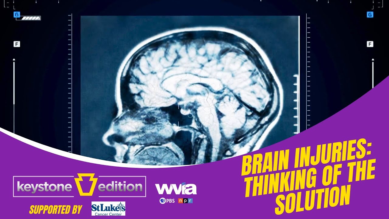 How Do Brain Injuries Affect Everyday Life?