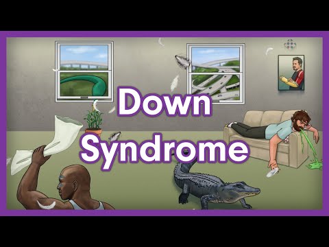 Down Syndrome (Trisomy 21) | USMLE Step 1 Mnemonic