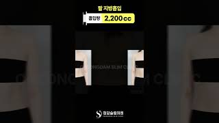 절대 안빠지는 팔뚝살 빼는 방법