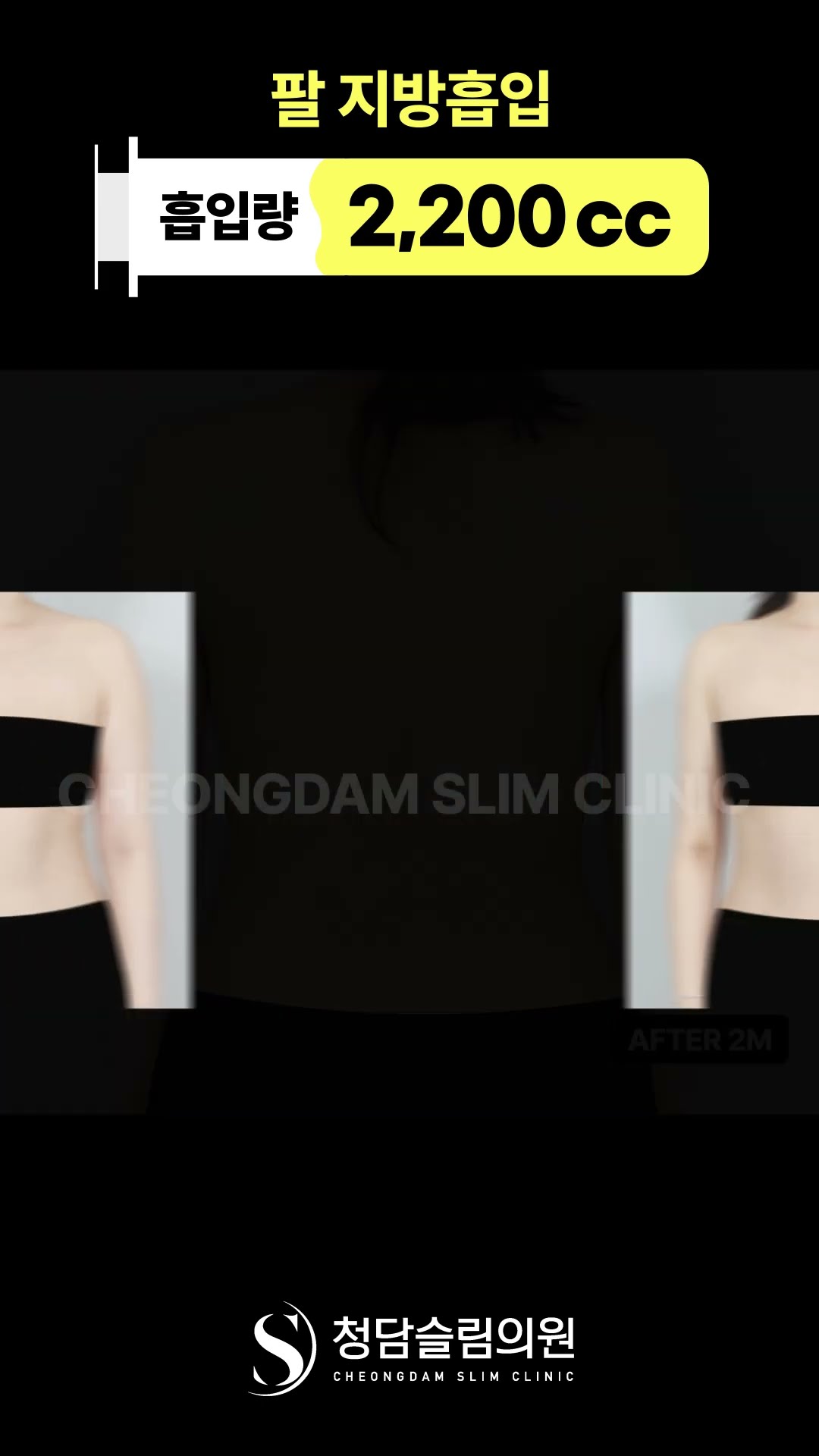 절대 안빠지는 팔뚝살 빼는 방법