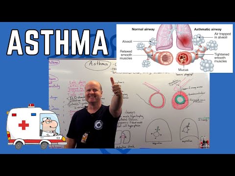 Asthma Pathophysiology Explained