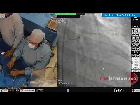 Ultra low contrast PCI in LAD and RCA