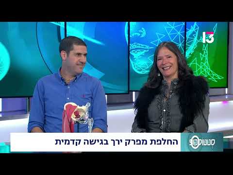 החלפת מפרק ירך בגישה קדמית