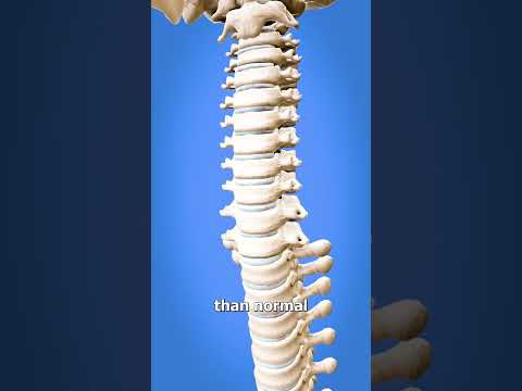 How To Spin Your Head Like An Owl 😳