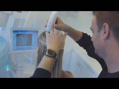 Josfine   behandling af hårtab