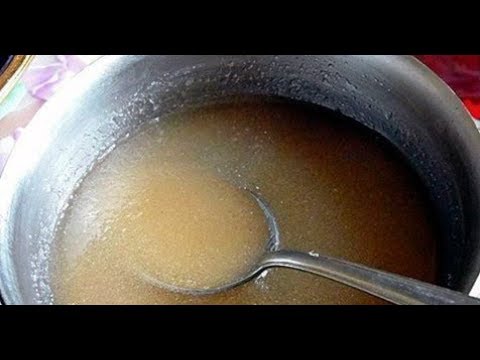 Головные боли из за проблем с шеей Если болит шея отложение солей