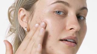 Clinique Anti-Blemish Solutions™ Maquillaje para Piel con Granitos anuncio