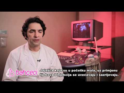 Koliko dana traje tretman vantjelesne oplodnje? Koliko često trba dolaziti na praćenje?