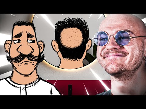 Devenir Chauve : ÇA FAIT QUOI ?!