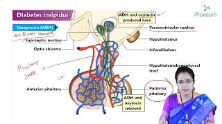 Diabetes Insipidus (Hindi) : Internal Medicine