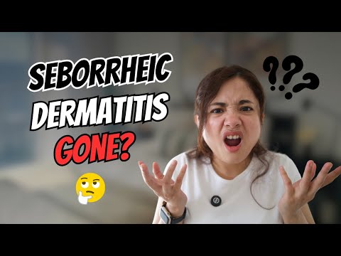 Seborrheic Dermatitis on face? This Is the Only Fix That Works!