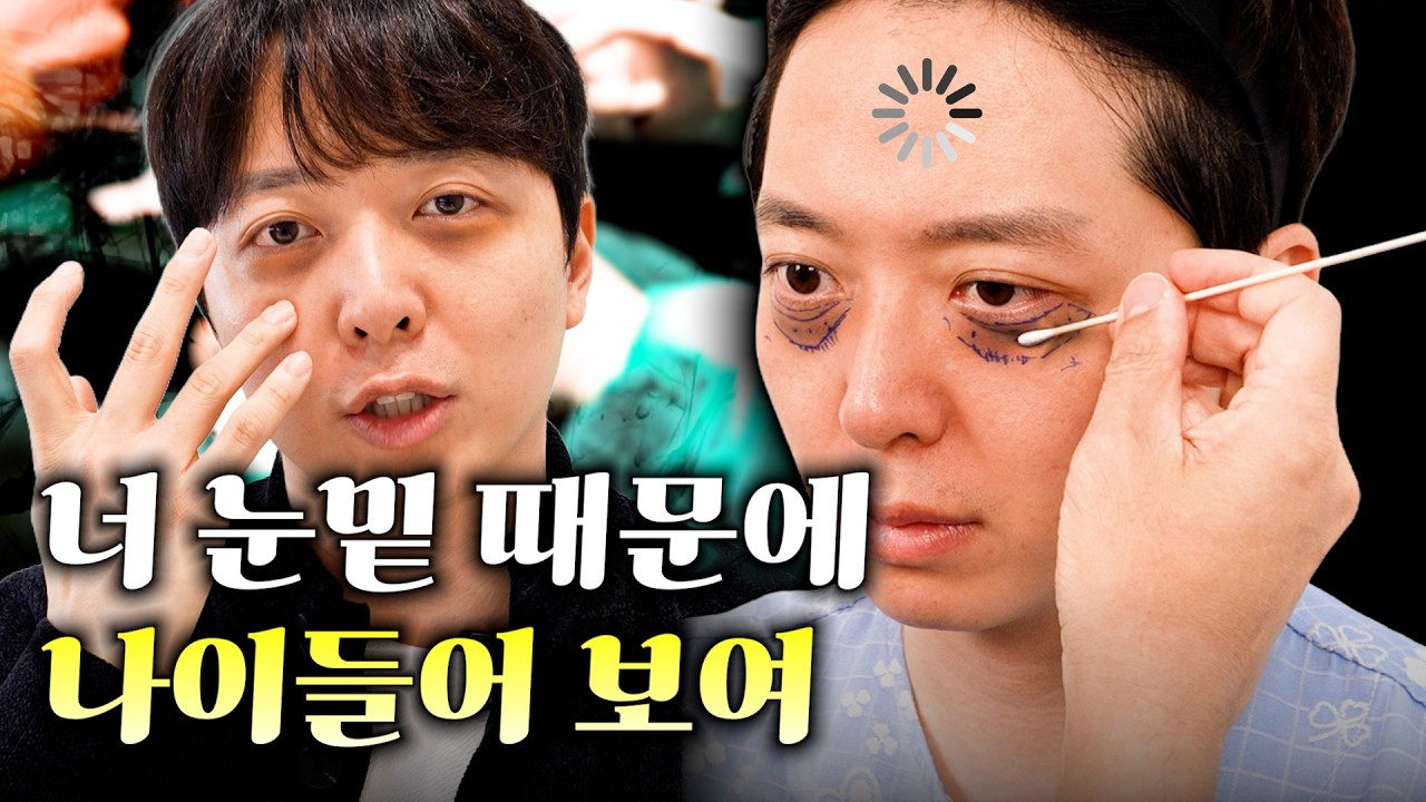 동안을 원하는 30대라면 이 수술 솔직히 필수임ㅇㅇ