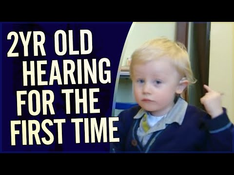 Amazing Video - 2 year old hears for the first time during Cochlear Implant activation Unedited
