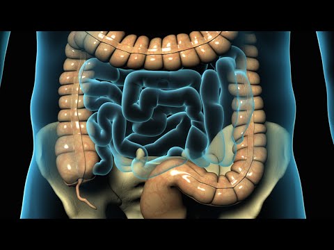Laparoscopic Appendectomy Surgery for Appendicitis (2008)