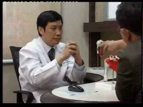 หน้าอกเล็กส่ง RU หน้าอกก่อนหลังจากพลาสติก
