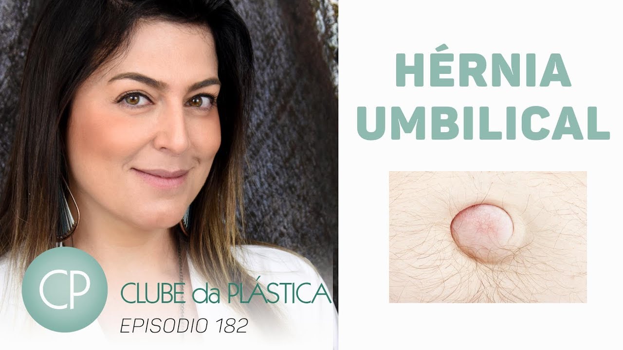 Clube da Plástica: A Hérnia Umbilical