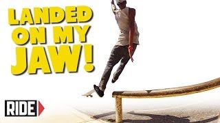 LANDED ON MY JAW! Skateboarding Slam - Laderek Nettles