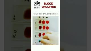ABO Blood Grouping | class 11th biology| body fluids and circulation| #neet2023#neetbiology#biology