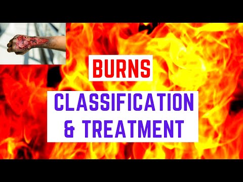 Burns - Classification and Treatment