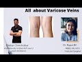 Get To Know About Varicose Veins With Dr Nupur Bit