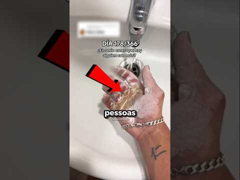 Os Calos Dele São Gigantes 🤯