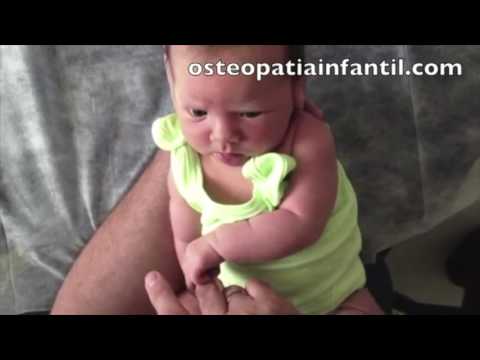 Bebé con Lesión del plexo braquial 3 y 4