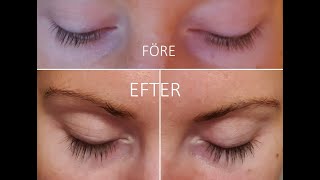 XLASH ÖGONFRANSSERUM UPP TILL BEVIS/RESULTAT