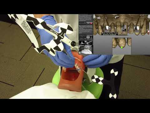 Endo: Calcified Canals